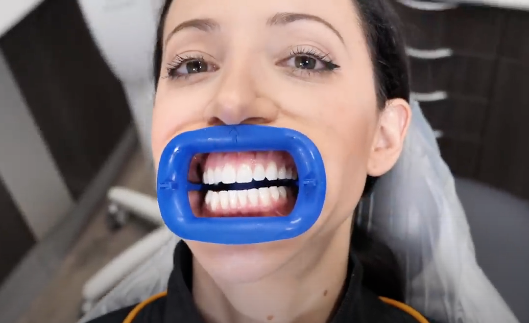 Dentist Teeth Whitening or At Home Teeth Whitening, What’s the Difference?